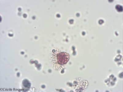 protozoo/Leegardiella sp(1)(copy)_thumb.jpg